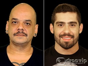 BBB12 - Joao Carvalho e Yuri