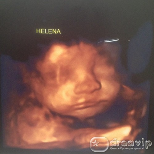 Rodrigo Faro posta foto de ultrassonografia