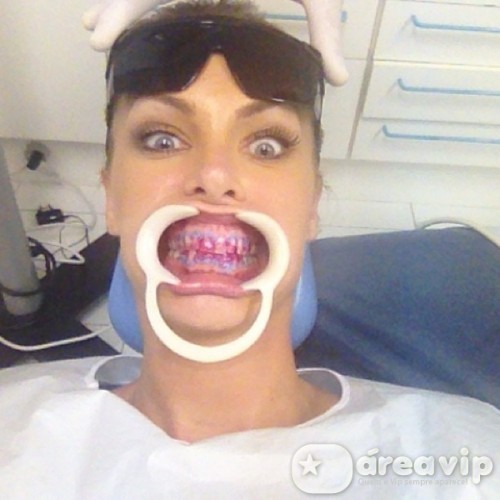 Ana Hickmann posta foto no dentista