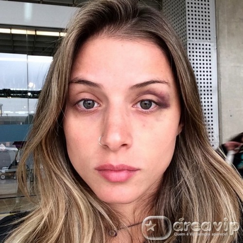 Angela Sousa faz desabafo e mostra hematomas no rosto