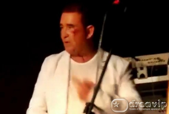 Amado Batista leva pedrada no rosto em show – Veja!