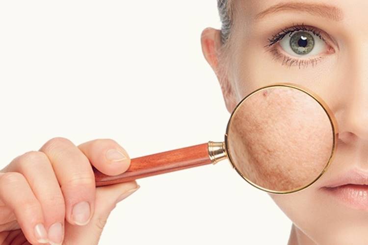Saude e Beleza - Manchas no Rosto Reprodução/Google Images