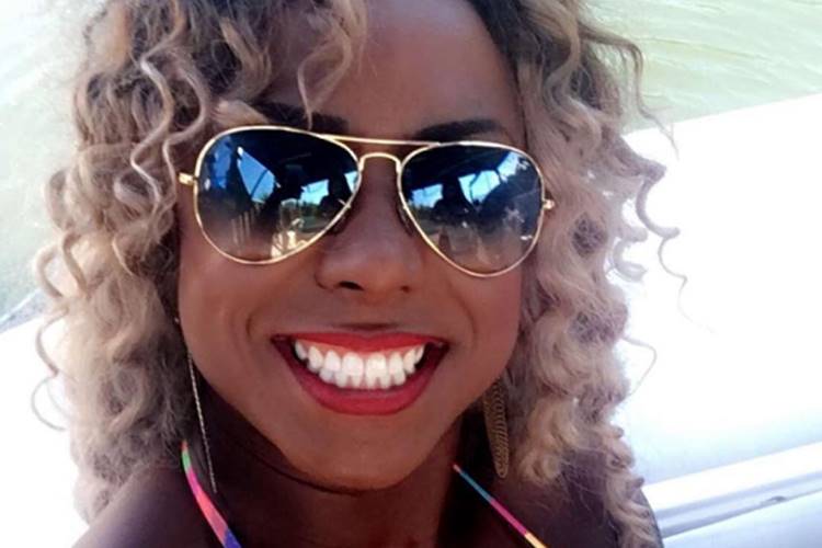 Ex-BBB Adélia faz mais uma cirurgia plástica