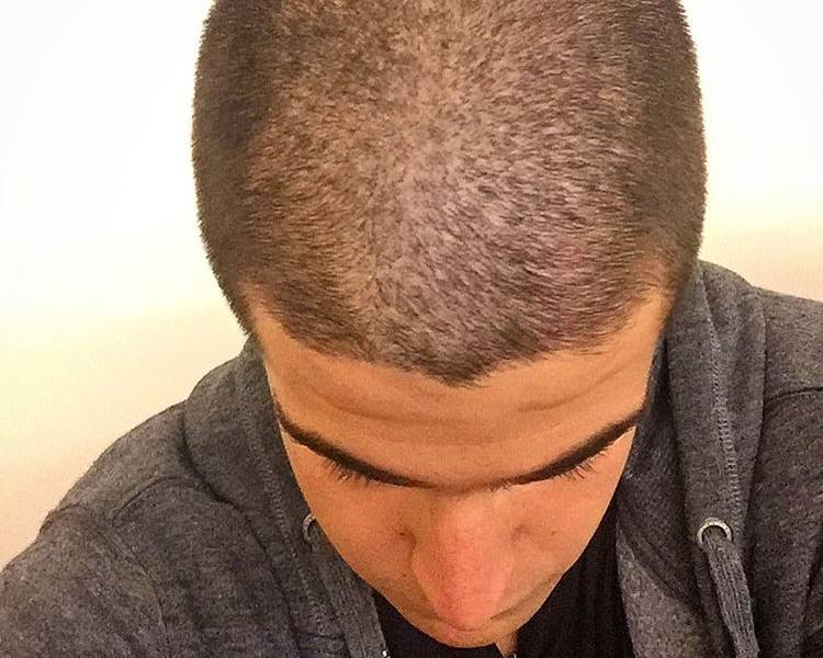 Enzo Celulari raspa a cabeça em homenagem ao pai