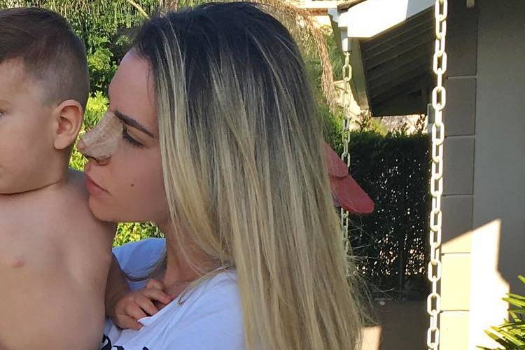 Adriana SantAnna opera o nariz Adriana SantAnna opera o nariz (Instagram)