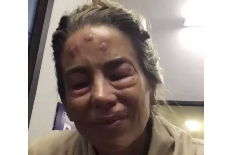 Danielle Winits brinca que sofreu agressão e divide opinião dos seguidores