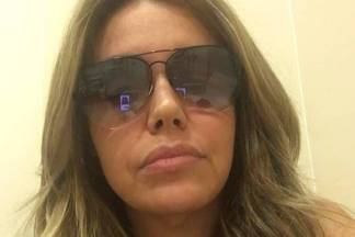 Renata Banhara revela identidade do marido agressor/Instagram