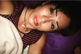 Cris Lopes com a boca machucada - Reprodução/Instagram