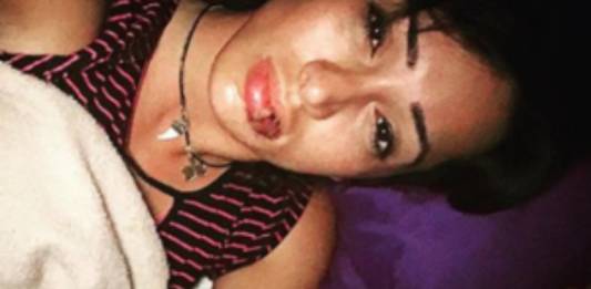 Cris Lopes com a boca machucada - Reprodução/Instagram