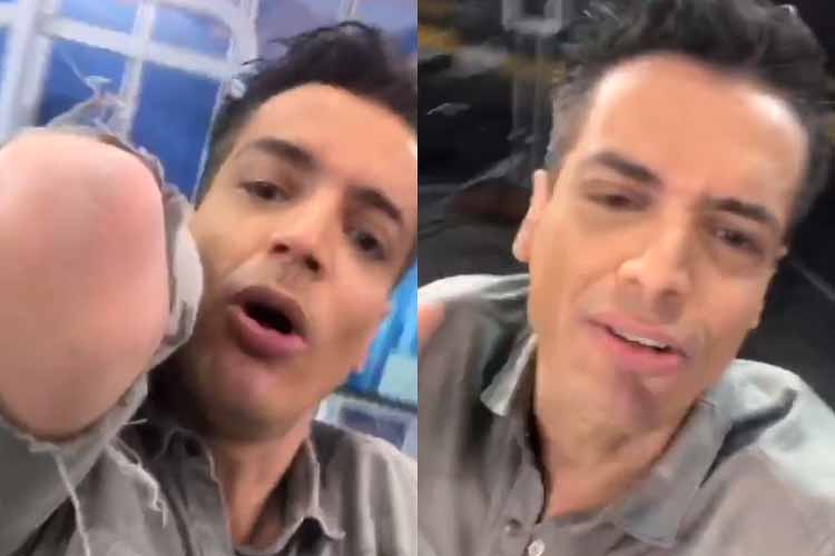 Leo Dias aparece com camisa rasgada e responde seguidores