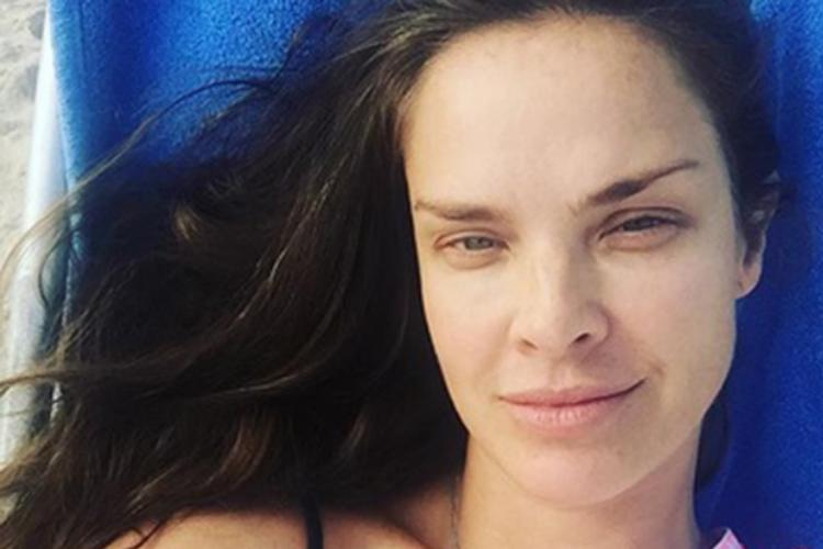 Letícia Birkheuer precisará passar por cirurgia; saiba mais