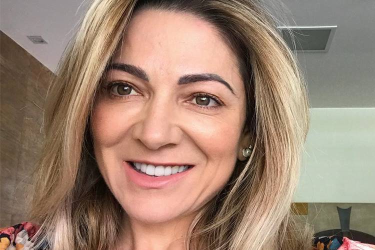 Mãe de sertanejo posta antes e depois e impressiona: “Muito melhor agora”