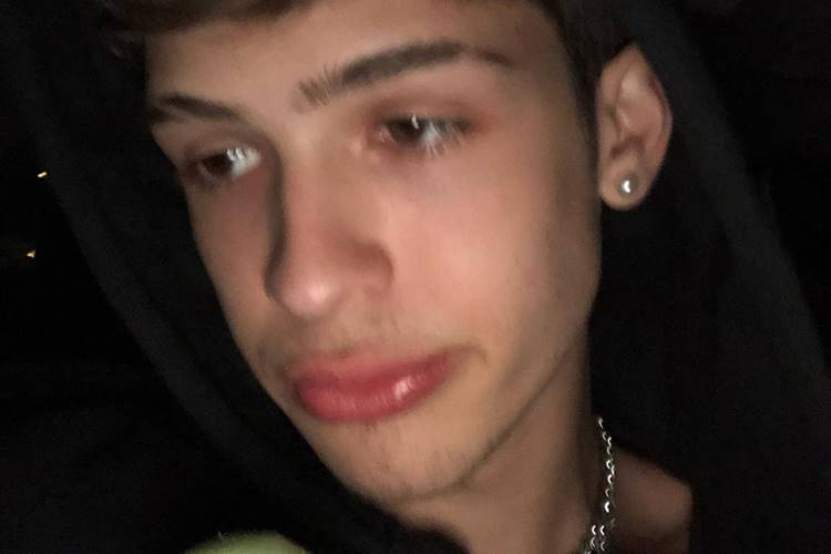 Filho do cantor sertanejo Leonardo causa espanto ao surgir com dente quebrado