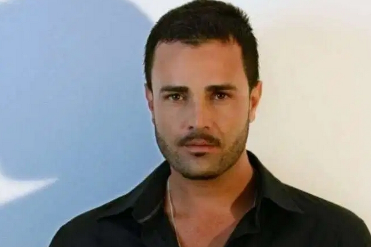 Antes de entrar em ‘A Fazenda’, Rodrigo Phavanello realizou cirurgia facial; veja