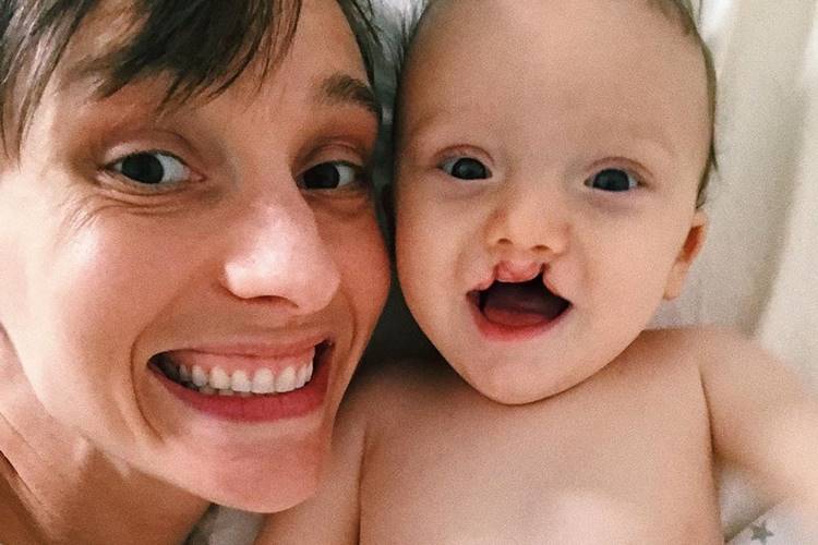 Irmã de Ana Hickmann relembra cirurgia do filho: “Esperei muito pra postar essa foto”