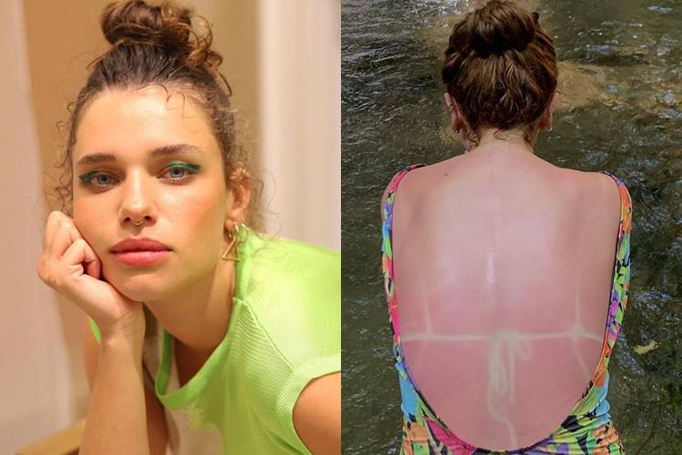 Bruna Linzmeyer exagera no sol e mostra resultado