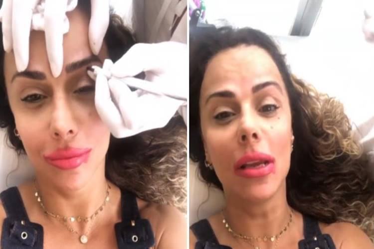 Viviane Araújo mostra processo de micropigmentação nas sobrancelhas e na boca