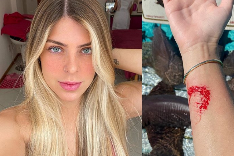 Digital influencer é atacada por tubarão durante viagem de férias nas Bahamas