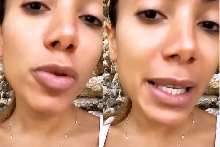Sem maquiagem, Anitta desabafa sobre problemas no visual durante quarentena