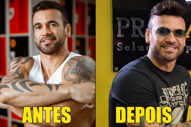 Prótese capilar: a mais nova aquisição de Hadson — Foto: Reprodução/Instagram