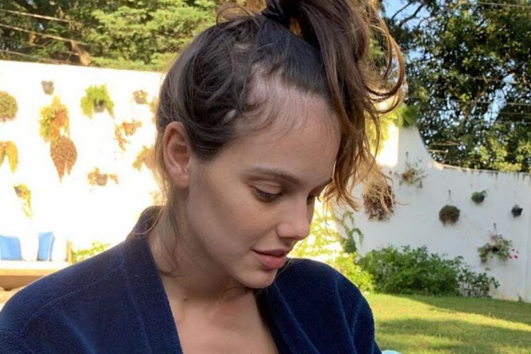 Laura Neiva faz desabafo após descobrir doença