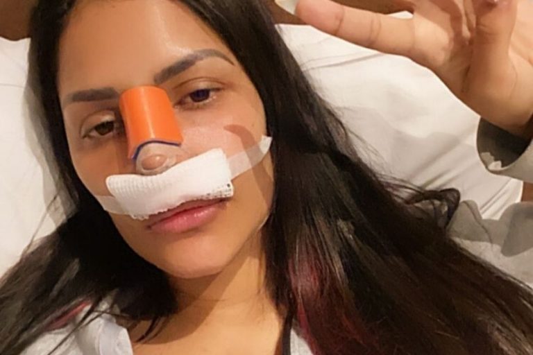 Ex-BBB Flayslane surge com curativo no nariz e preocupa fãs