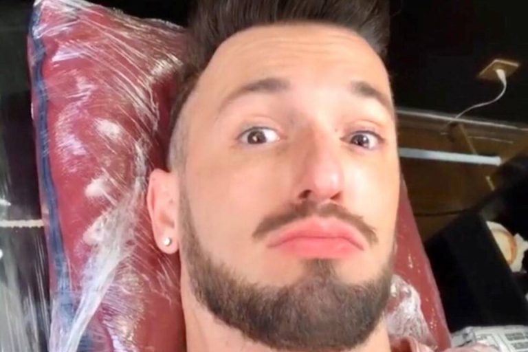 Diego Hypolito realiza procedimentos estéticos e mostra ‘antes e depois’