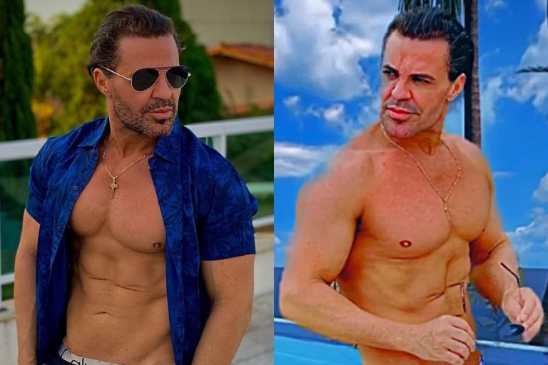 Sertanejo Eduardo Costa faz revelação bombástica sobre cirurgia plástica