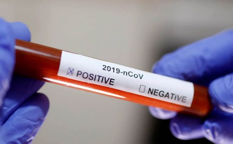 Nova pandemia? Vidente revela sonho e faz pedido: ‘Por favor!