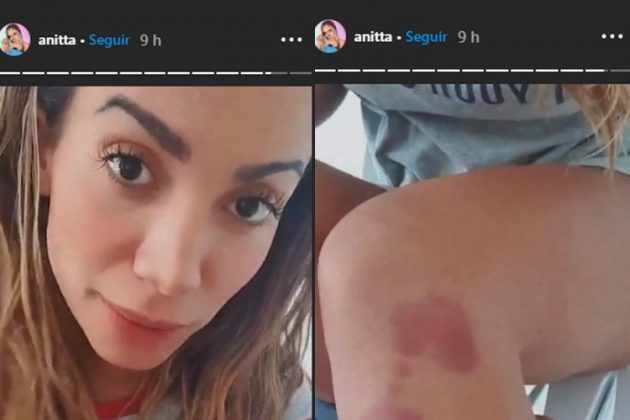 Anitta reprodução Stories Instagram