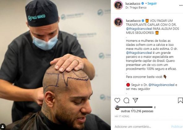 Reprodução Instagram Lucas Lucco faz promoção e promete pagar transplante capilar a seguidor