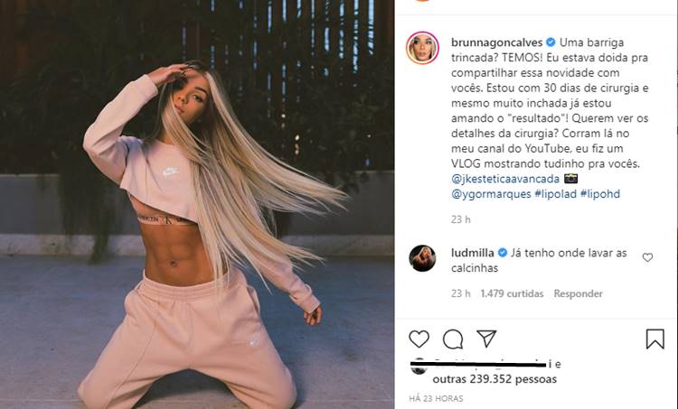 Brunna Gonçalves, esposa de Ludmilla, passa por cirurgia para conseguir barriga trincada