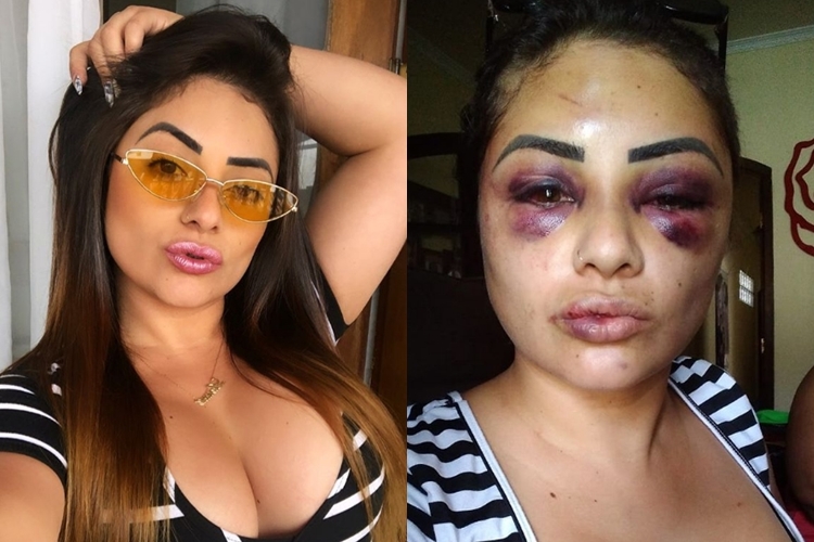 Digital Influencer Larissa Marília sofre agressões e relata: “Tentaram furar meus olhos”