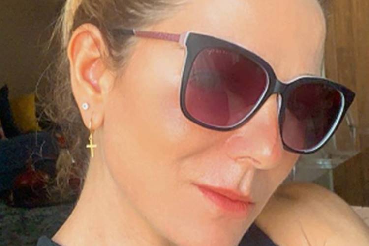 Após realizar procedimento estético, Karina Lucco mostra antes e depois