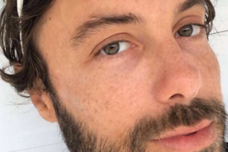 Kayky Brito Kayky Brito sofre pequeno 'acidente doméstico' e mostra testa machucada - Foto: Reprodução/instagram@kayli.brito