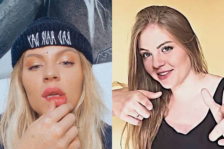Luísa Sonza atualmente e com 17 anos Luísa Sonza revela se já fez algum procedimento estético - Foto: Reprodução/ Instagram@luisasonza/montagem Área VIP