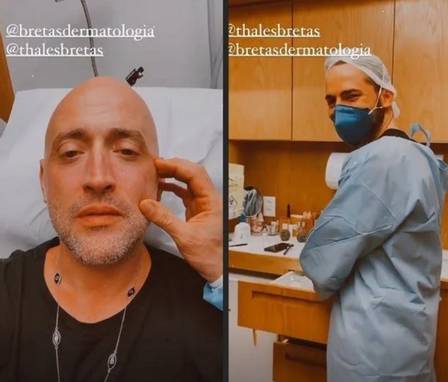 Paulo Gustavo surge com visual diferente após procedimento estético, confira! - Foto: Reprodução/Instagram@thalesbretas