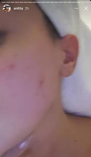 Anitta/ Instagram