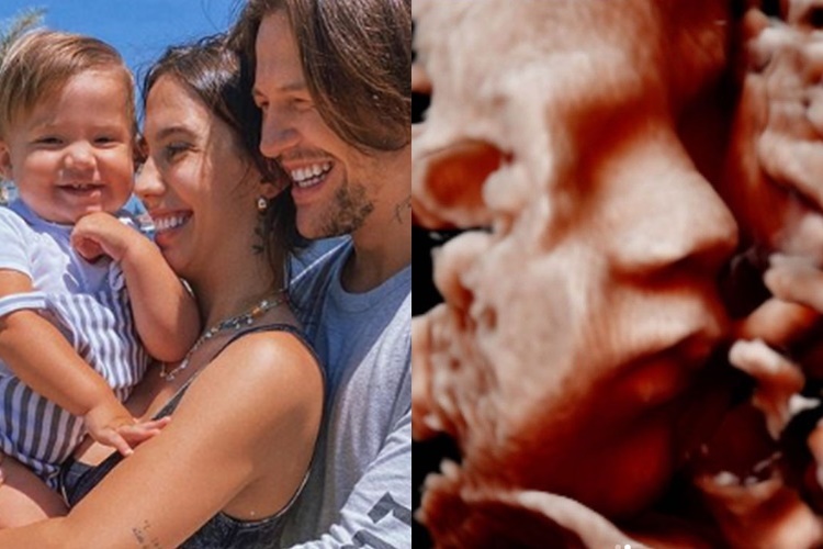 Grávida, Gabi Brandt mostra rostinho de bebê no ultrassom - Foto: Reprodução/ Instagram/Montagem/Área VIP