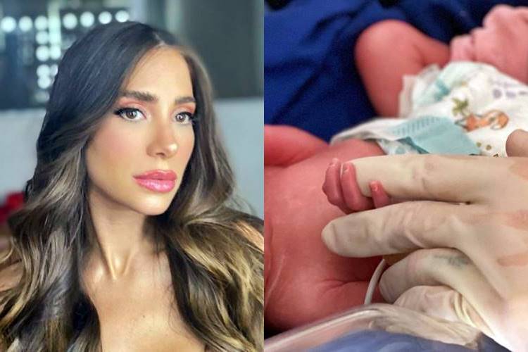 Romana Novais exibe hematomas após parto arriscado: ''Marcas do amor'' - Foto: Reprodução/Instagram/Montagem Área VIP