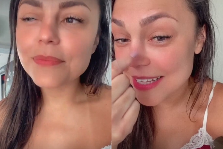 Humorista Bruna Louise faz relato sobre pequeno acidente: ‘Quebrei esse nariz’