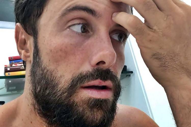 Ator Kayky Brito resolve fazer teste da Covid-19 - Foto: Reprodução/Instagram