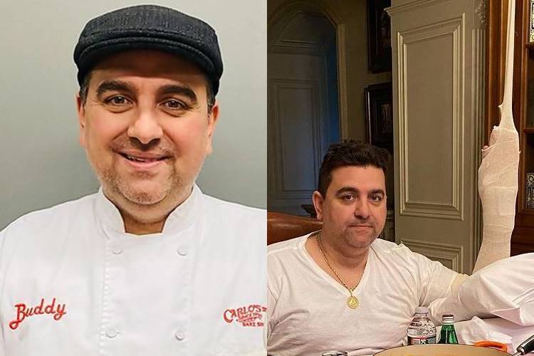 Após grave acidente, Buddy Valastro passa por quarta cirurgia na mão - Foto: Reprodução/ Instagram/ Montagem Área VIP