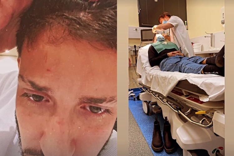 Vinícius Martinez se acidenta e leva pontos na cabeça