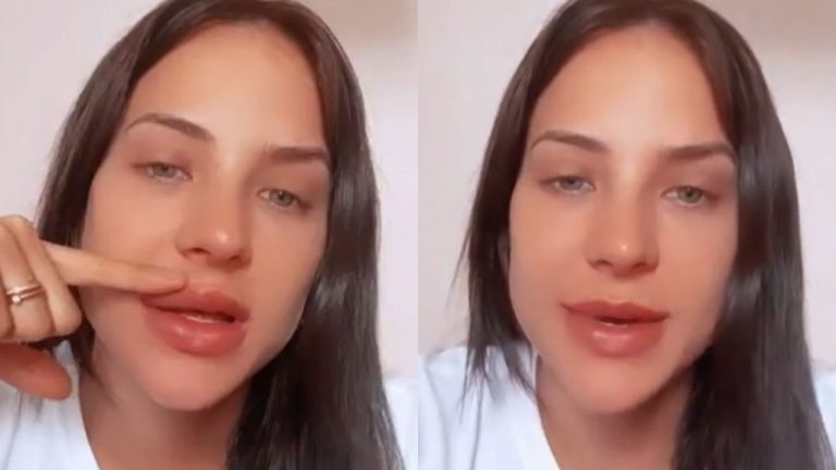 Gabi Martins passa por novo procedimento: “Vai demorar um pouquinho para ficar normal”