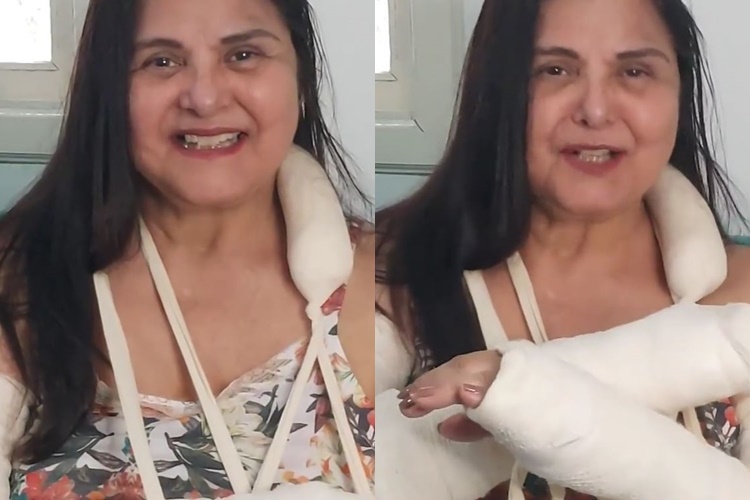 Atriz Elizângela sofre acidente doméstico: “Tive fratura nos dois antebraços”