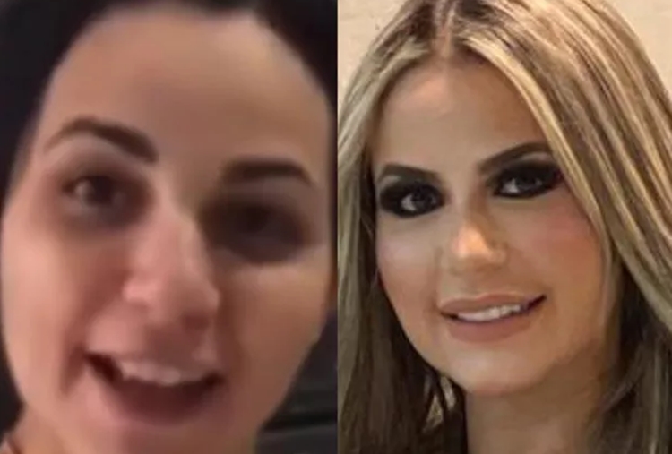 Deolane Bezerra Antes e depois da influenciadora Deolane Bezerra (Foto: Reprodução/Instagram)