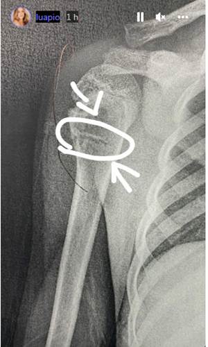 Luana Piovani filho 2 - print stories