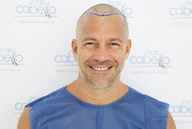 Malvino - Foto Divulgação