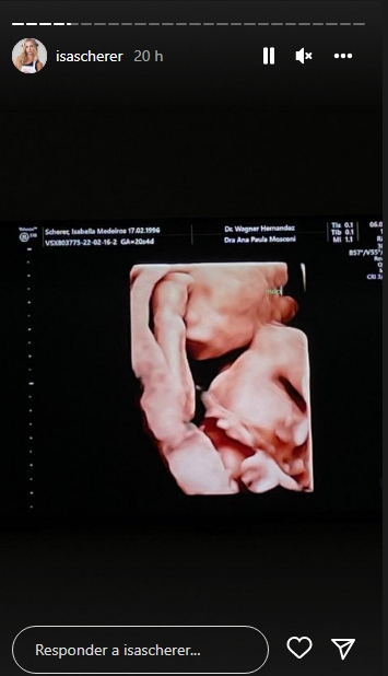 Isa Scherer Ultrassom reprodução Instagram